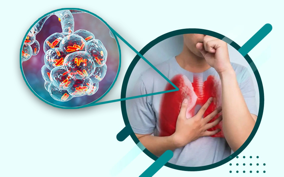 Ziua Mondială de combatere a tuberculozei (TB) 2025