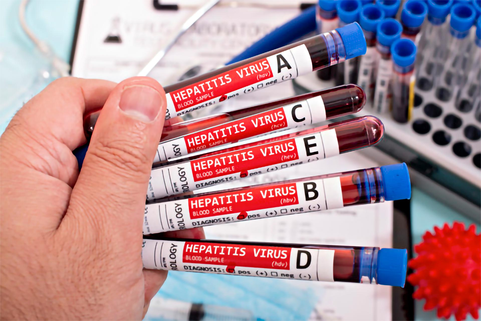 Ziua Mondială a Hepatitei 2020