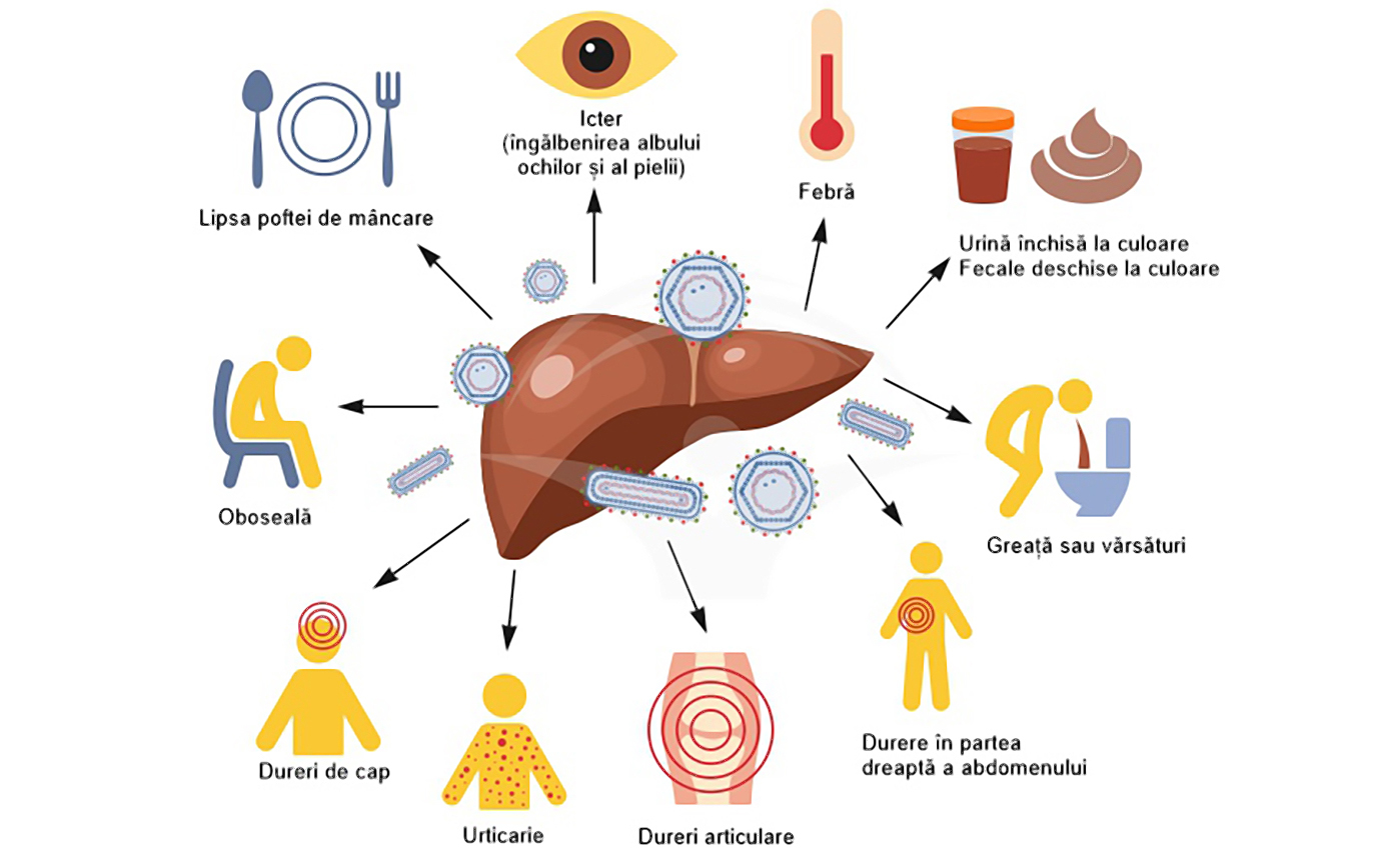 Ziua mondială de combatere a hepatitei