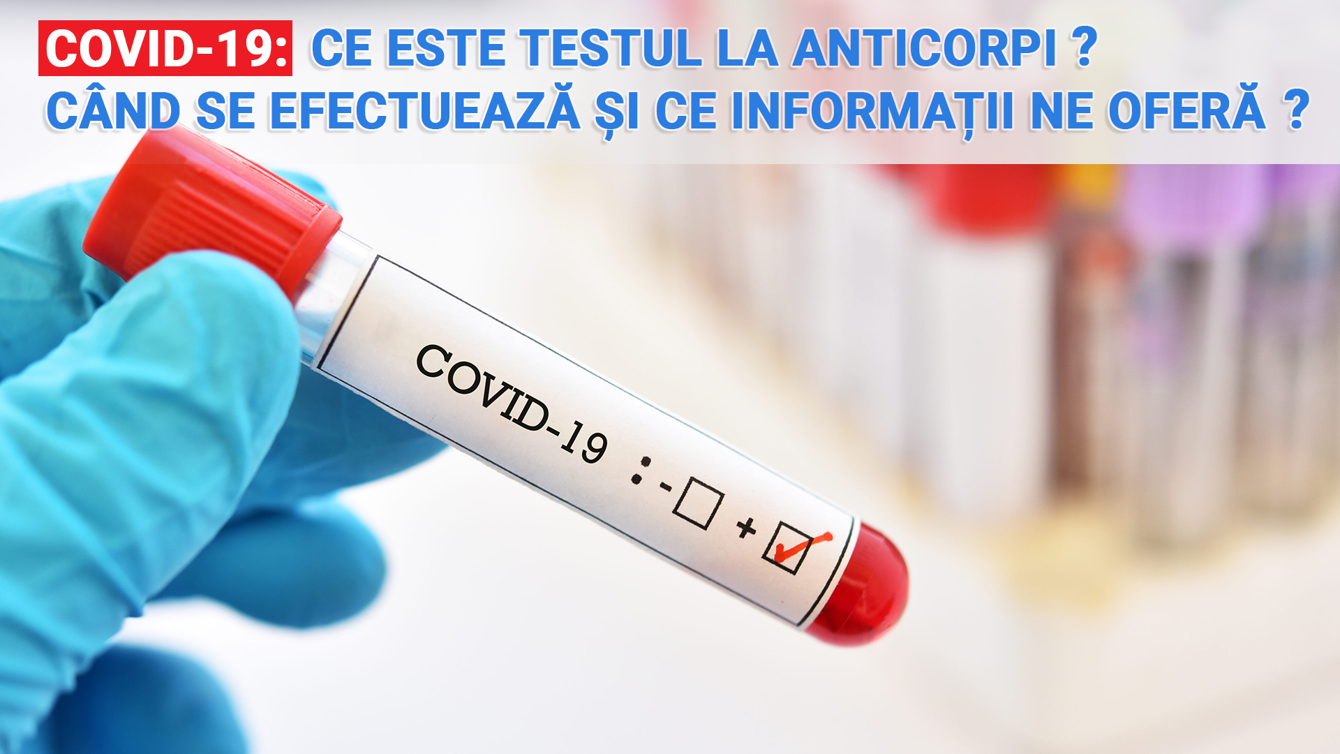 COVID-19: ce este testul la anticorpi, când se efectuează și ce informații îți oferă