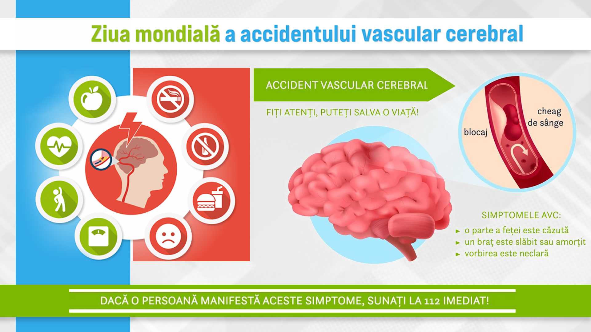 Ziua mondială a accidentului vascular cerebral 